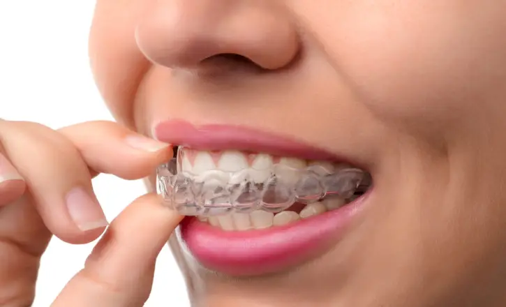 What Is the Future of Braces